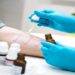 Everything you need to know concerning an allergic reaction and allergy testing