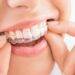 How Should You Care For Your Clear Aligners?